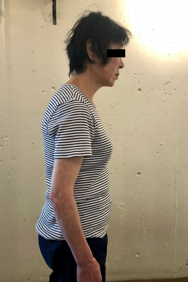 before画像
