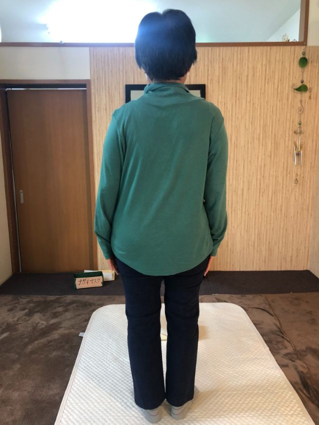 after画像