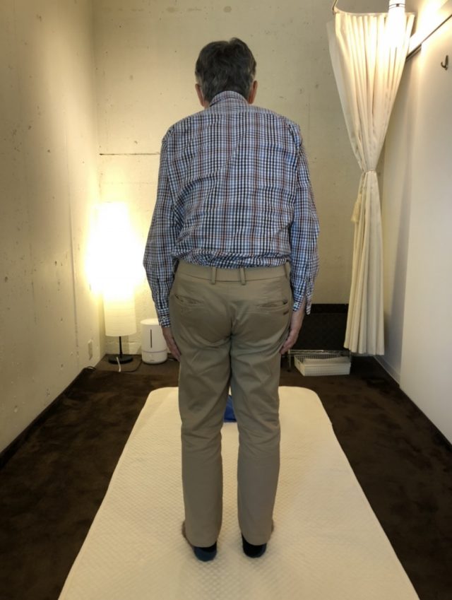 before画像
