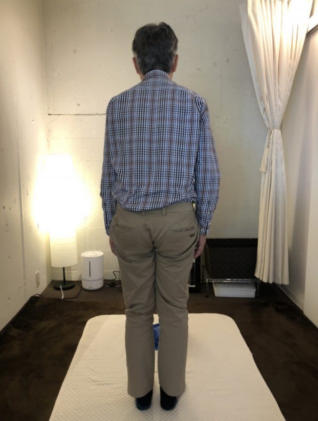 after画像
