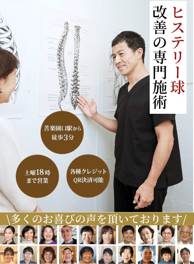 ヒステリー球