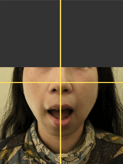 after画像